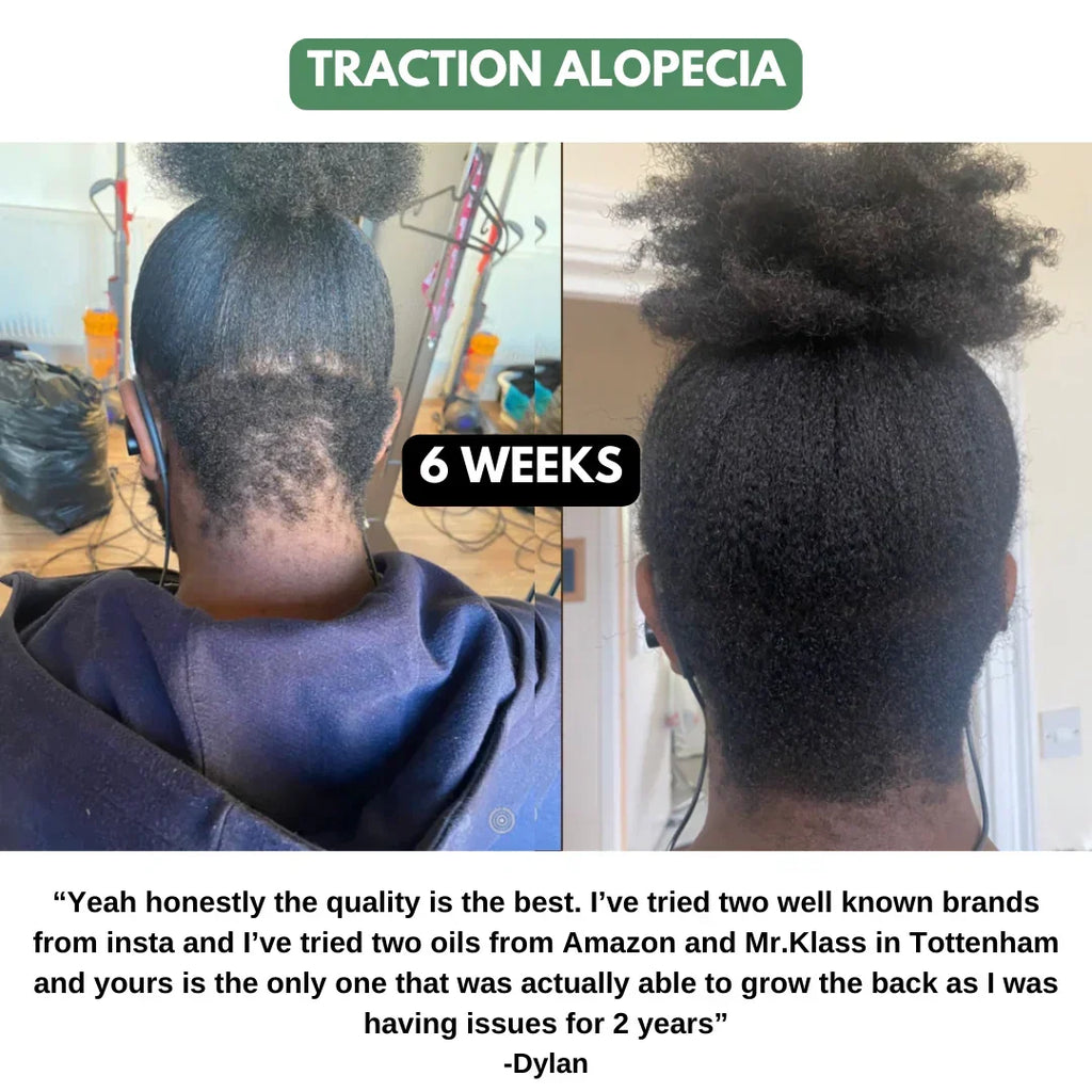 The Ultimate Hair Growth Set for Textured Hair