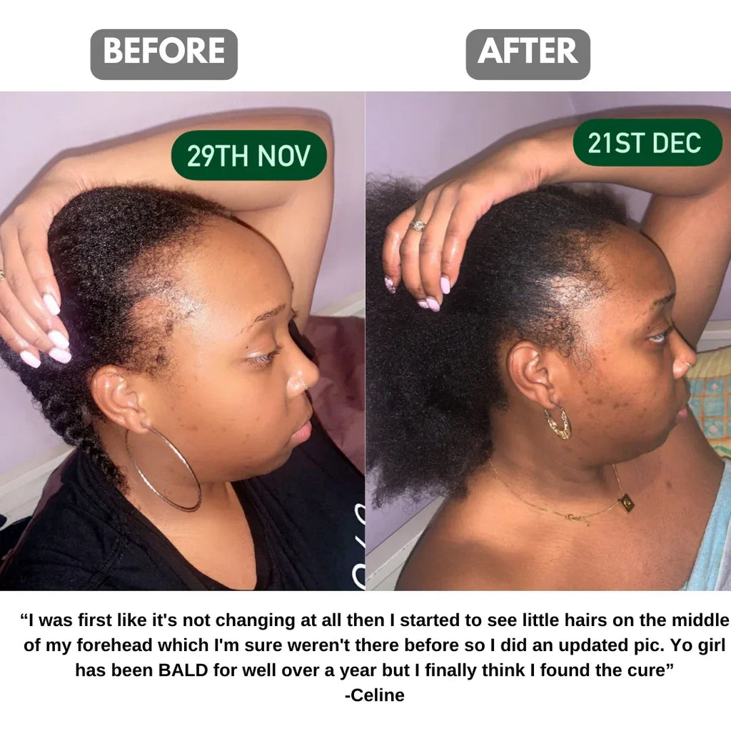 The Ultimate Hair Growth Set for Textured Hair