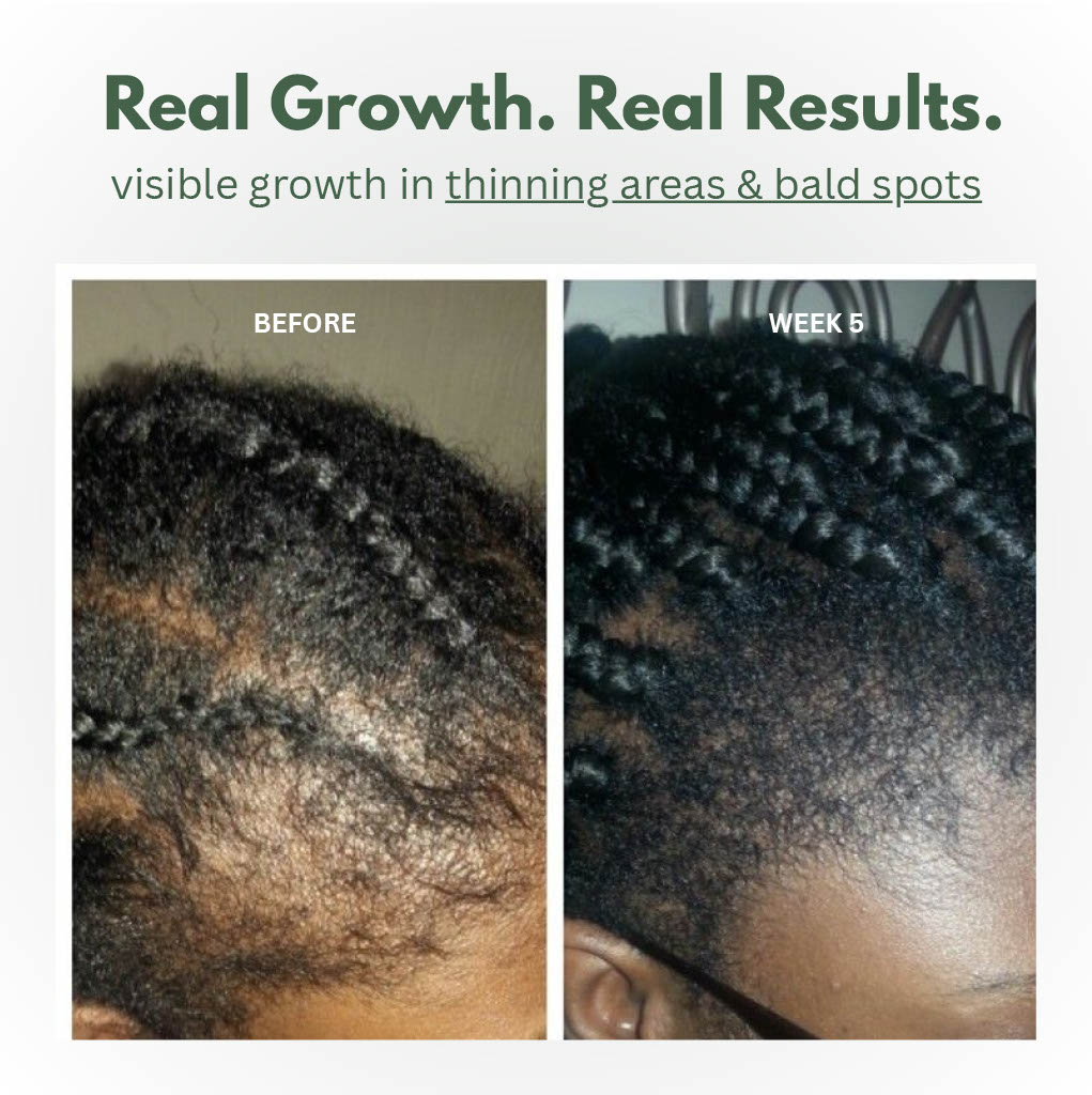 Scalp Serum Batana